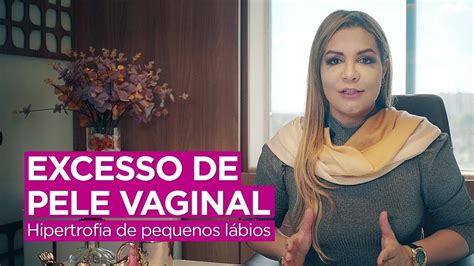 labios vaginales grandes|Hipertrofia vaginal: qué es, síntomas y tratamiento